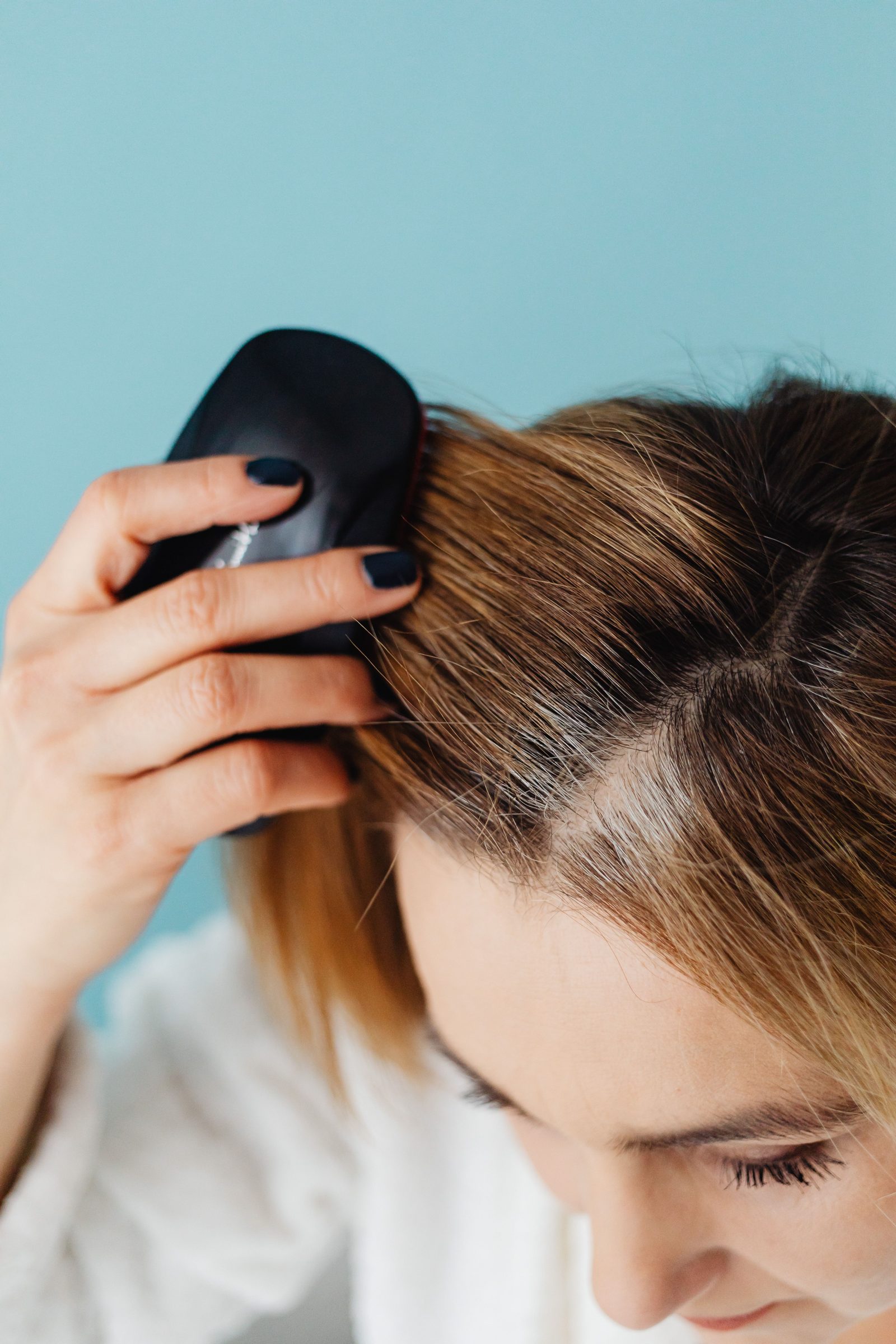 A close-up scalp and hair analysis, as revealed by K Scan